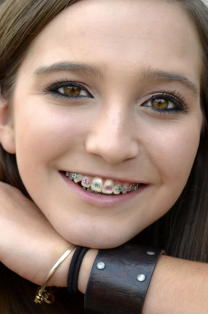 Prix broches dentaires au Québec