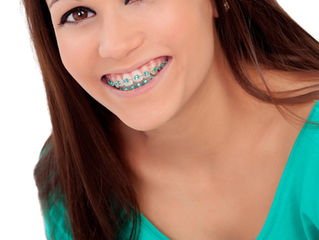 Your Braces price for Montreal, QC