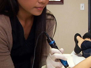 ไมโครนีดลิ่ง (Microneedling): การฟื้นคืนความอ่อนเยาว์ของผิวหนัง