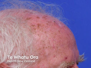 Skin care assessment dermatology