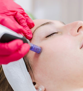 microneedling.jpeg