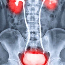 Urograma Excretor UIV: Técnica, Protocolo e Interpretación Radiológica