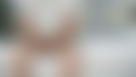 Dr. Segnini ecografía escrotal varicocele