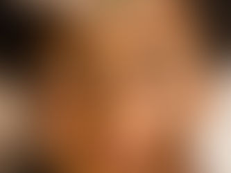 Microagulhamento: descubra os benefícios dessa técnica revolucionária para a pele.