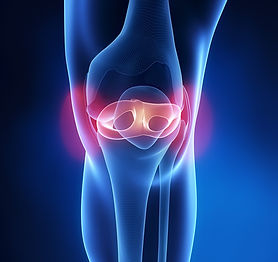 Knie_2.jpg