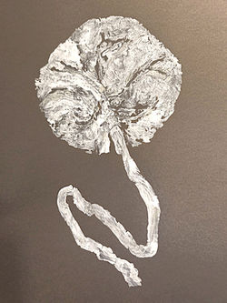 Placenta5