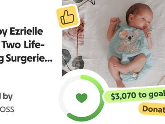 Help Baby Ezrielle Through Two Life-Changing Surgeries