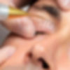 Large area - Fibroblast Plasma Pen