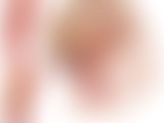 Por que tenho que me preocupar com a minha carótida?