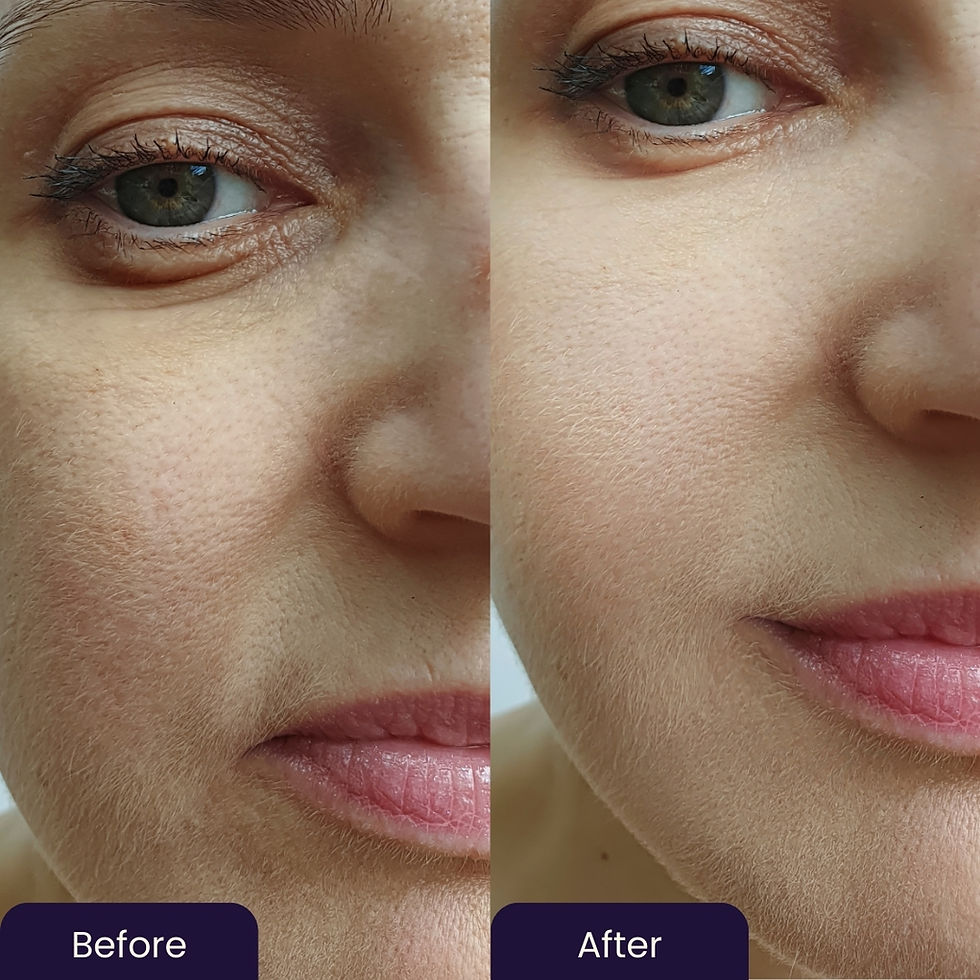 Thumbnail: Hyaluronate Hydrating Skin Mist