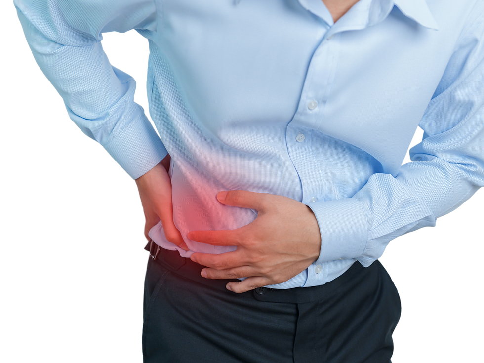 Representation of kidney stones