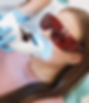 Laser Teeth Whiten.png