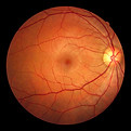 retina normal