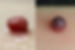 braunfalco_tumors.jpg