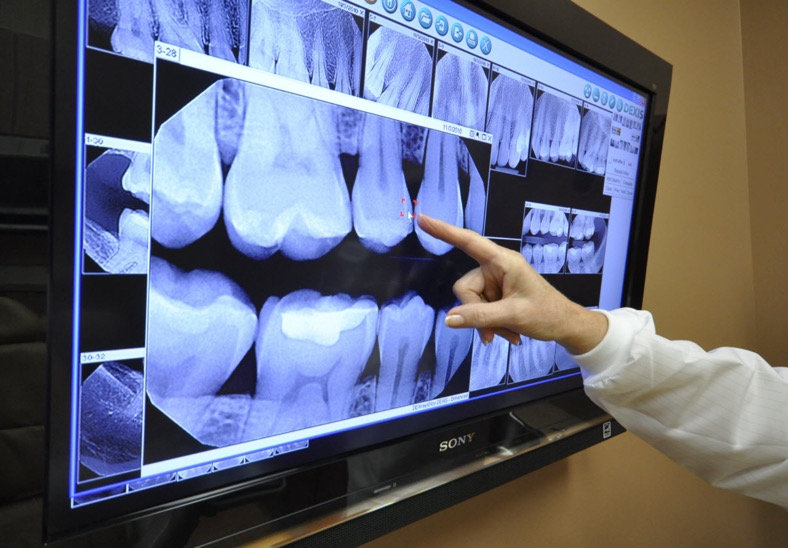 Dental X-Ray Imaging