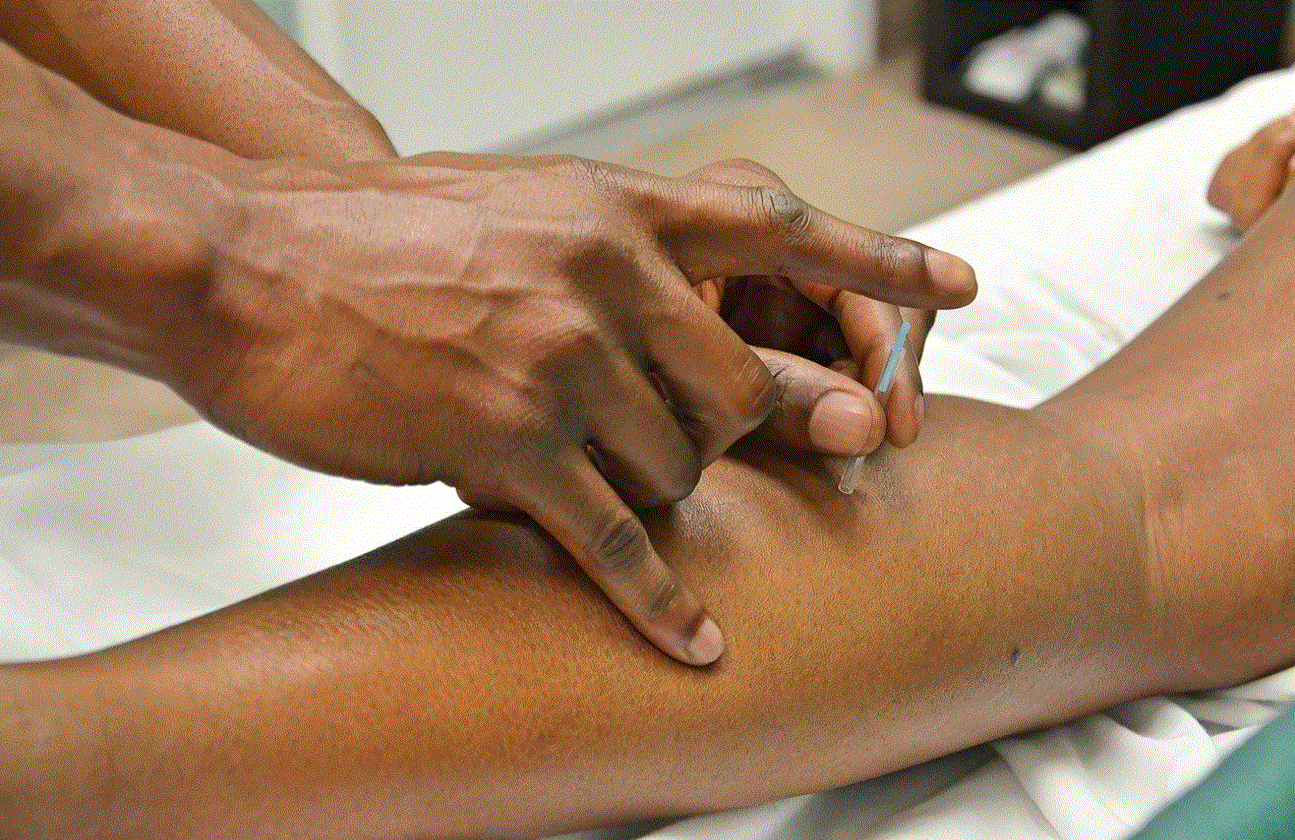 Acupuncture could relieve pain, reduce inflammation that causes illness