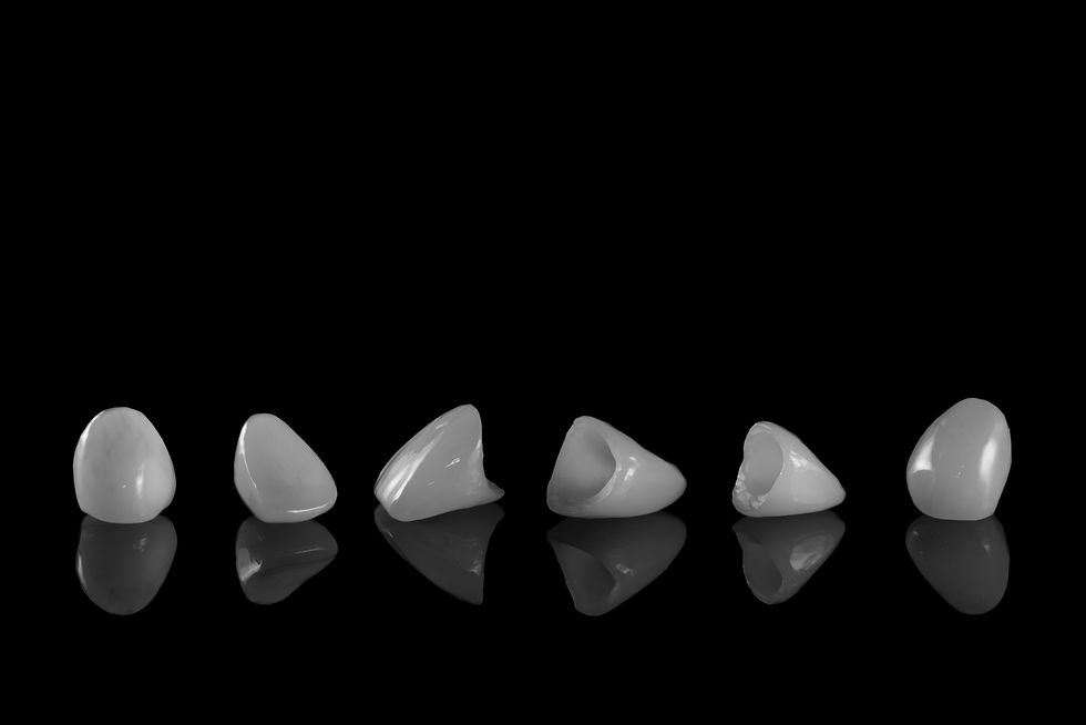 Why Does My Dental Crown Look Different from My Friend's?