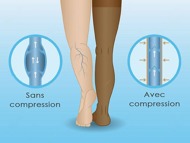 cabortho | semelles orthopédiques | Orthopédiste orthésiste | Anthony Massonniere | Roanne Le Coteau