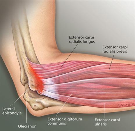 Musculoskeletal depiction of lateral arm