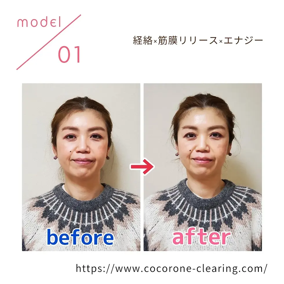 ビフォーアフター