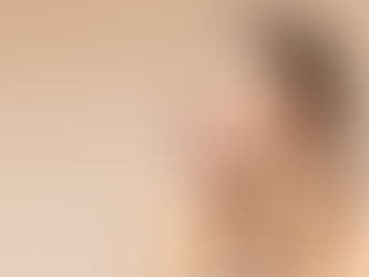 Is Rhinoplasty in Dubai Worth It? Tips for Evaluating the Pros and Cons