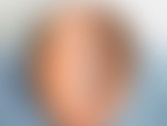إيجابيات وسلبيات زراعة الشعر في دبي