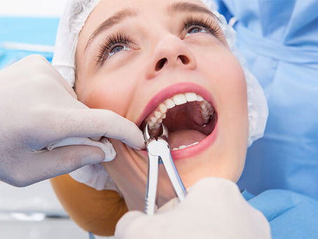 Unpacking the cost of tooth extraction in Dubai for first-timers