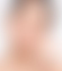 How to Prepare for Permanent Skin Whitening Treatments in Dubai: Essential Tips and Advice