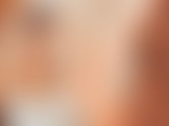 زراعة الشعر في دبي – ما يجب أن تعرفه