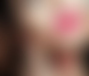 What Are the Side Effects of Pink Lips Laser Treatment in Dubai? Important Considerations