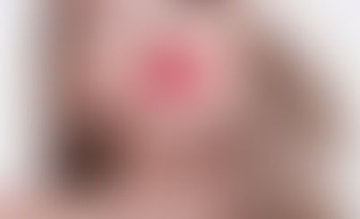 From Thin to Plump: The Ultimate Guide to Lip Fillers in Dubai