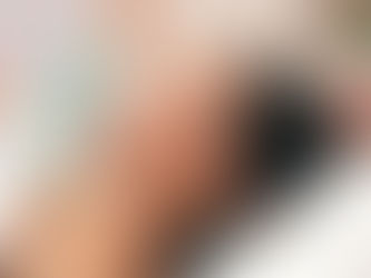 How Effective is Soft Light Laser for Your Skin Concerns? Tips and Insights for Dubai Residents