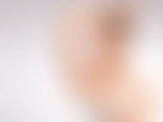 Dubai’s Soft Light Laser Trend: How It’s Revolutionizing Beauty and Wellness