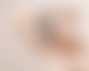 Achieve Glowing Skin with Soft Light Laser Treatments in Dubai