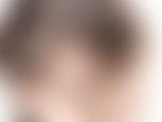 كل ما تحتاج لمعرفته حول زراعة الشعر في دبي