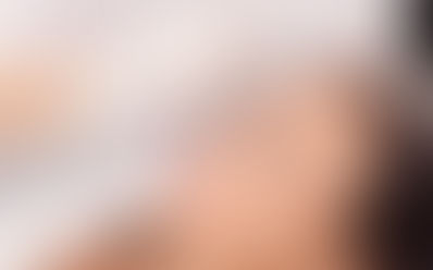 Transform Your Appearance with Botox® Injections in Dubai