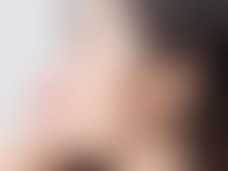 Is Rhinoplasty Worth It in Dubai? Pros, Cons, and Key Considerations