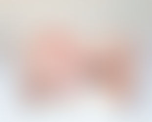 Fimose: Sera que meu filho tem?