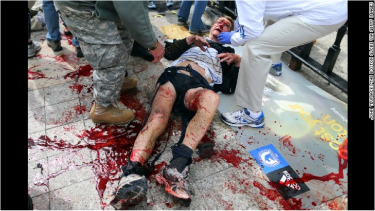 Boston Marathon Bombing