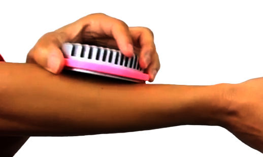 Thumbnail: Universal Burn Pain Relief