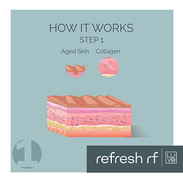 REFRESH RF_How It Works_1.jpg