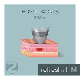 REFRESH RF_How It Works 2.jpg