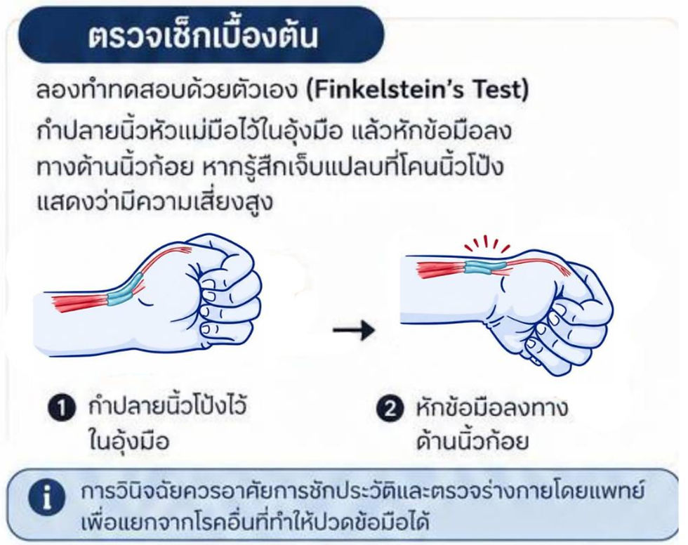 Finkelstein’s test ประเมินภาวะ (De Quervain’s Disease เดอ กาแวง)