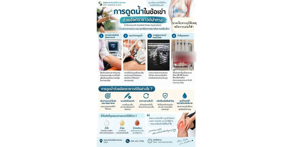 การดูดน้ำในข้อเข่าด้วยอัลตราซาวด์นำทาง (Ultrasound-Guided Aspiration) เพิ่มความแม่นยำในการรักษา
