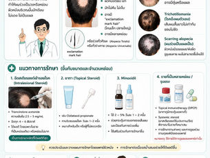 ผมร่วงเป็นหย่อม (Alopecia areata) 🧠 คืออะไร โรคภูมิคุ้มกันทำลายรากผม ผมร่วงเป็นวง หย่อม ขอบชัด