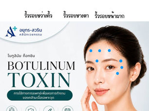 ริ้วรอย...ไม่คอยใคร โปรแกรมฉีดโบทูลินุ่ม ท็อกซิน
