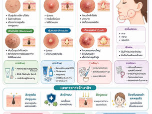สิว สาเหตุ การรักษา การดูแล IPL RF หลุมสิว
