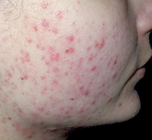 Schermafbeelding 2025-11-13 om 12.56.41.png