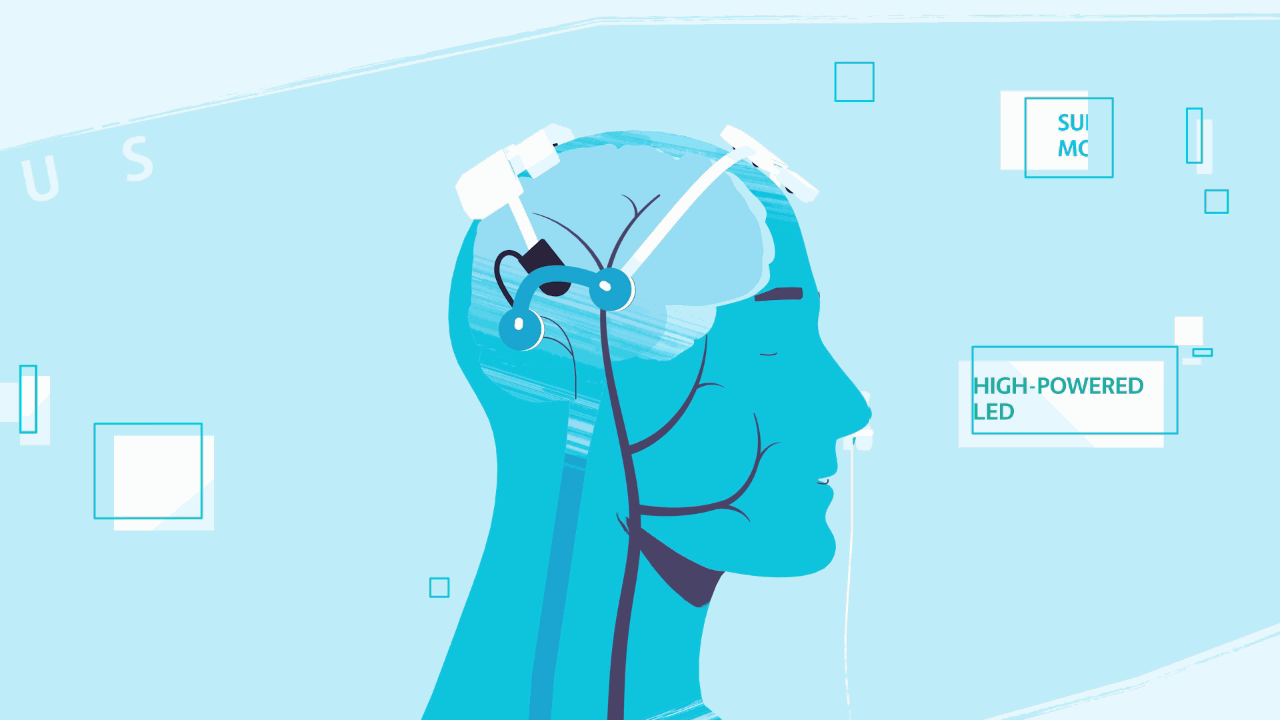 Neuro-gif-2.gif