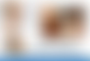 ESTÉTICAnews | O que é Fisioterapia Dermatofuncional?